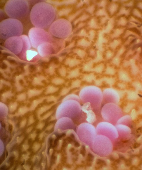 coral